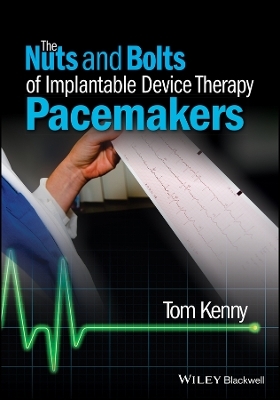 The Nuts and Bolts of Implantable Device Therapy – Pacemakers