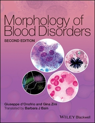 Morphology of Blood Disorders 2e