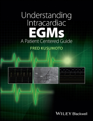 Understanding Intracardiac EGMs &ndash; A Patient Centered Guide - Fred M. Kusumoto