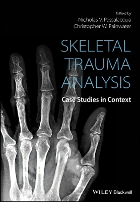 Skeletal Trauma Analysis &ndash; Case Studies in Context - 