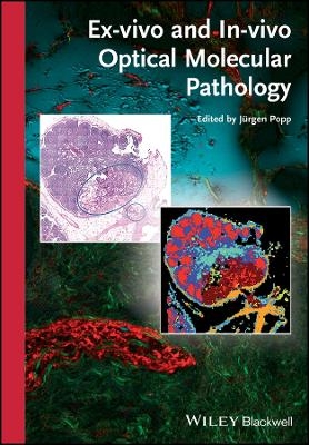 Ex&ndash;vivo and In&ndash;vivo Optical Molecular Pathology - 