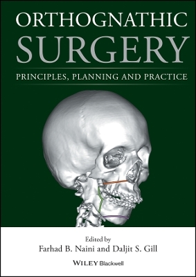Orthognathic Surgery &ndash; Principles, Planning and Practice - F Naini