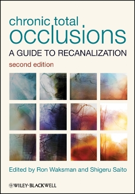 Chronic Total Occlusions &ndash;  A guide to recanalization 2nd Edition - R Waksman