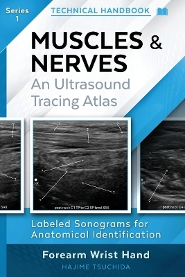 Technical Ultrasound Handbook - Muscles & Nerves - Hajime Tsuchida