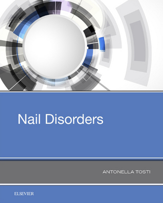 Nail Disorders