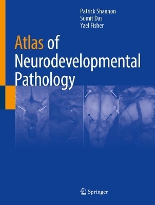 Atlas of Neurodevelopmental Pathology - Patrick Shannon, Sumit Das, Yael Fisher