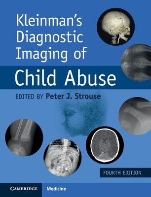 Kleinman's Diagnostic Imaging of Child Abuse - 