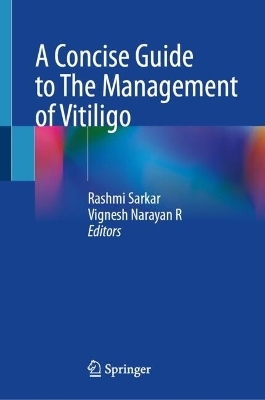 A Concise Guide to The Management of Vitiligo - 