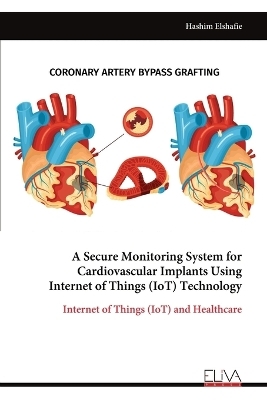 A Secure Monitoring System for Cardiovascular Implants Using Internet of Things (IoT) Technology - Hashim Elshafie