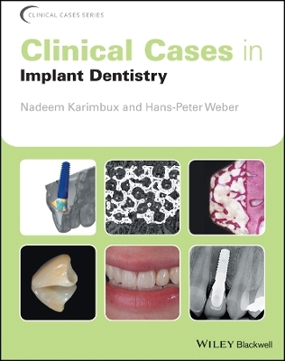 Clinical Cases in Implant Dentistry