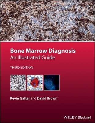 Bone Marrow Diagnosis – An Illustrated Guide 3e