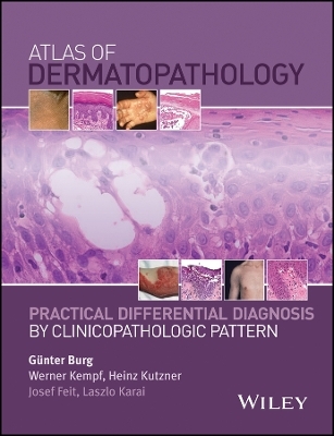 Atlas of Dermatopathology – Practical Differential Diagnosis by Clinicopathologic Pattern