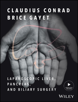 Laparoscopic Liver, Pancreas and Biliary Surgery &ndash; Textbook and Illustrated Video Atlas - C Conrad