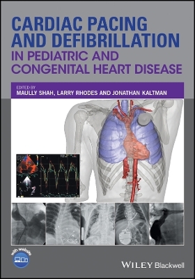 Cardiac Pacing and Defibrillation in Pediatric and Congenital Heart Disease