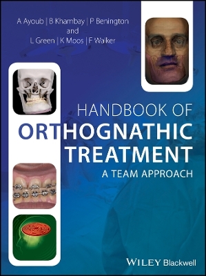 Handbook of Orthognathic Treatment &ndash; A team approach - A Ayoub