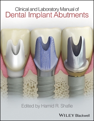 Clinical and Laboratory Manual of Dental Implant Abutments