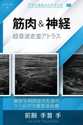 テクニカル超音波ハンドブック - 筋肉 & 神経