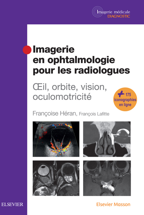 Imagerie en ophtalmologie pour les radiologues -  Francoise Heran,  Francois Lafitte
