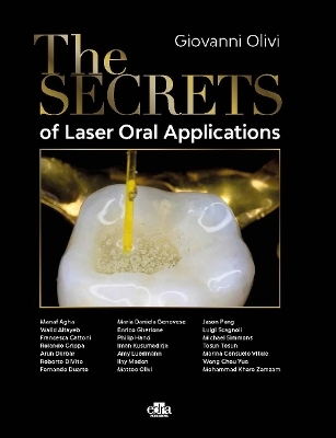 The Secrets of Laser Oral Application