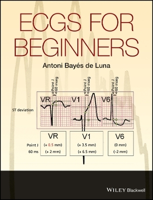 ECGs for Beginners - Antoni Bay&eacute;s de Luna
