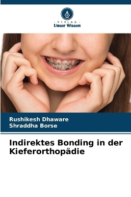 Indirektes Bonding in der Kieferorthopädie