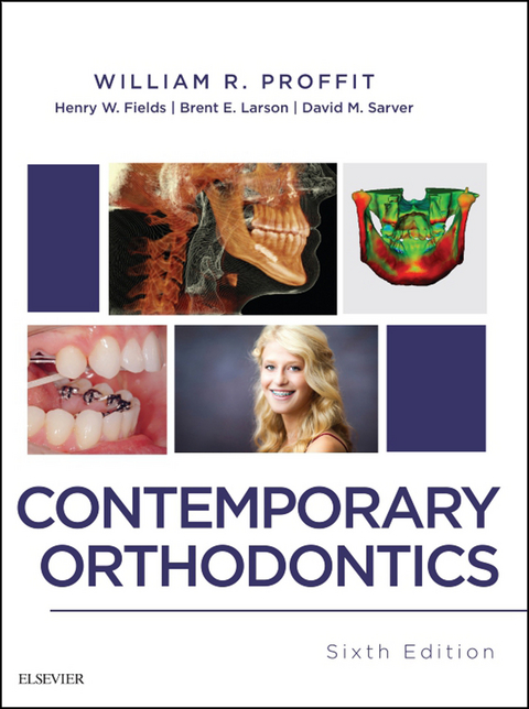 Contemporary Orthodontics - E-Book -  Henry Fields,  Brent Larson,  William R. Proffit,  David M. Sarver