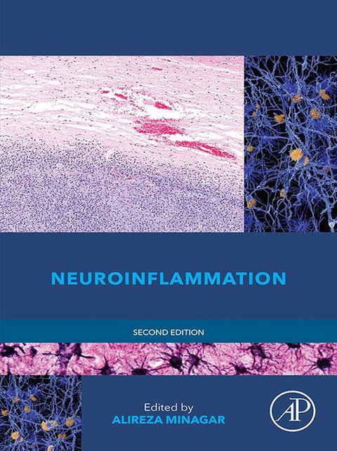 Neuroinflammation - 