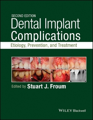 Dental Implant Complications – Etiology, , and Treatment, Second Edition