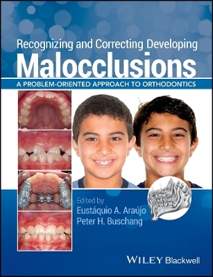 Recognizing and Correcting Developing Malocclusions – A Problem–Oriented Approach to Orthodontics