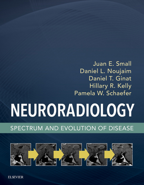 Neuroradiology -  Daniel T. Ginat,  Hillary R. Kelly,  Daniel L. Noujaim,  Pamela W. Schaefer,  Juan E. Small