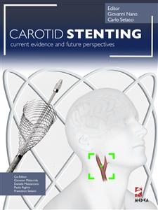 Carotid Stenting