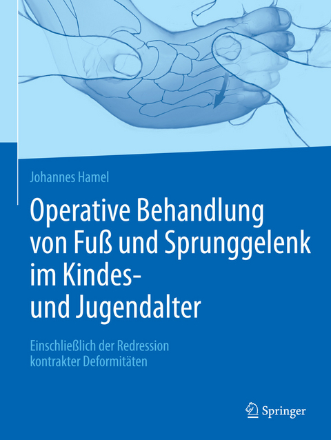 Operative Behandlung von Fu&szlig; und Sprunggelenk im Kindes- und Jugendalter - Johannes Hamel