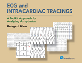ECG and Intracardiac Tracings - George J. Klein