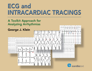 ECG and Intracardiac Tracings