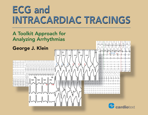 ECG and Intracardiac Tracings - George J. Klein