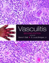 Vasculitis - Ball, Gene V.; Bridges, S. Louis, Jr.
