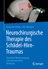 Neurochirurgische Therapie des Sch&auml;del-Hirn-Traumas - Alexander K&ouml;nig, Uwe Spetzger
