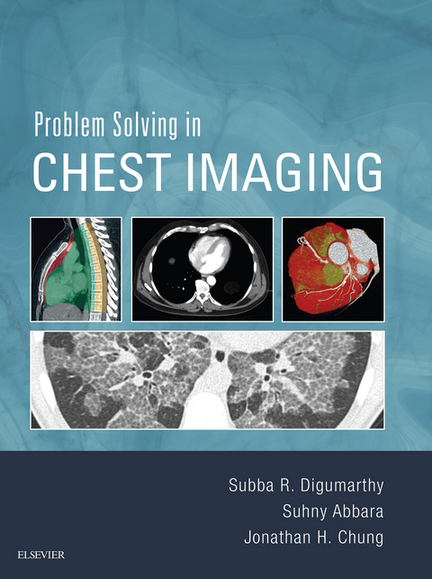 Problem Solving in Chest Imaging E-Book -  Suhny Abbara,  Jonathan H. Chung,  Subba R. Digumarthy