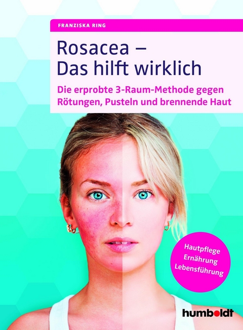 Rosacea &ndash; Das hilft wirklich - Franziska Ring