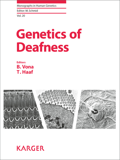 Genetics of Deafness - B. Vona