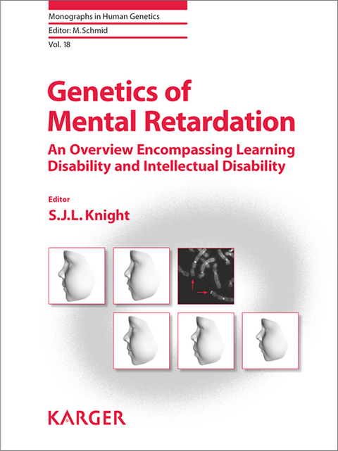Genetics of Mental Retardation - 