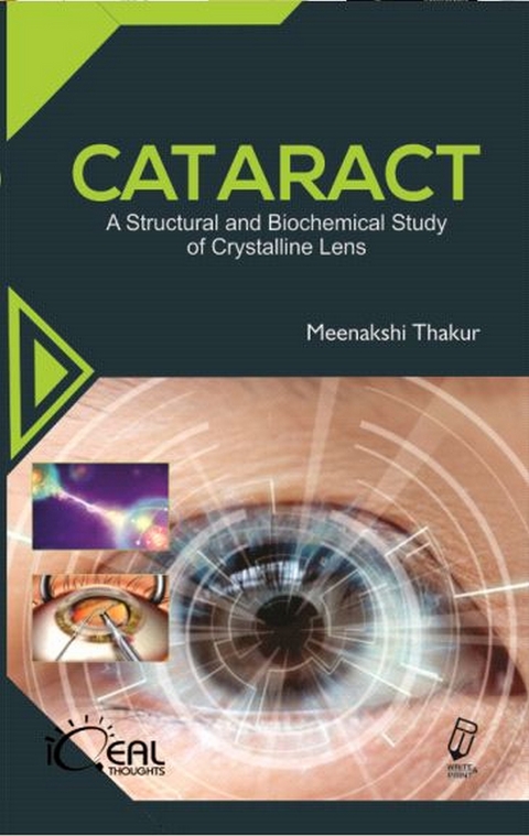 Cataract (A Structural And Biochemical Study Of Crystalline Lens) -  Meenakshi Thakur