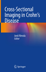 Cross-Sectional Imaging in Crohn&rsquo;s Disease - 