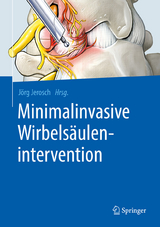 Minimalinvasive Wirbels&auml;ulenintervention - 