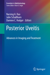 Posterior Uveitis - 
