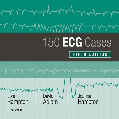 150 ECG Cases -  John Hampton,  David Adlam,  Joanna Hampton