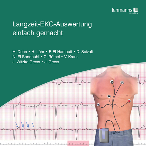 Langzeit-EKG-Auswertung einfach gemacht - Helma Dehn, Heike L&ouml;hr, Faiza El-Hamouti, Daniela Scivoli, Nora El-Bondouhi, Vanessa Kraus, Christina R&ouml;thel, Jutta Witzke-Gross, Joseph Gross