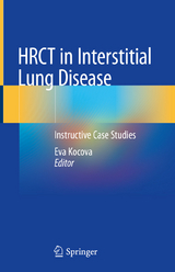 HRCT in Interstitial Lung Disease - 