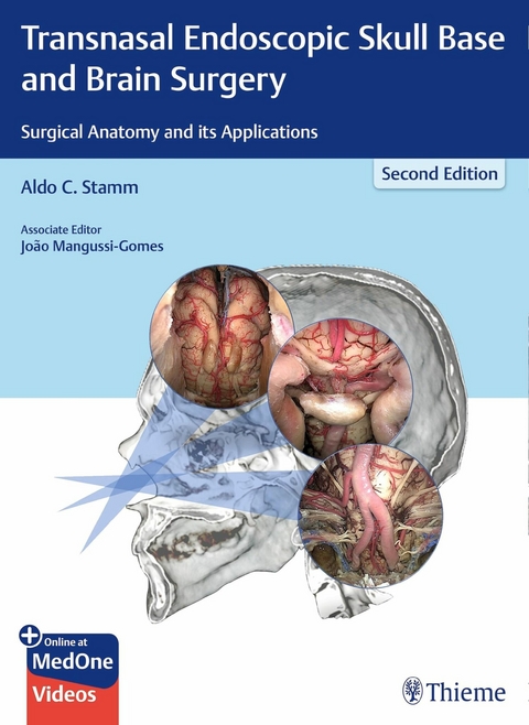 Transnasal Endoscopic Skull Base and Brain Surgery - 