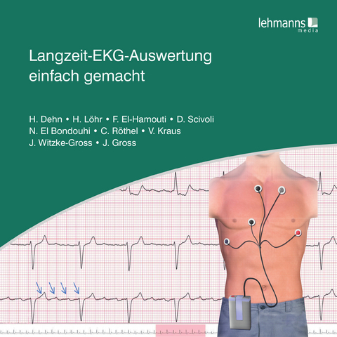 Langzeit-EKG-Auswertung einfach gemacht - Helma Dehn, Heike L&ouml;hr, Faiza El-Hamouti, Daniela Scivoli, Nora El-Bondouhi, Vanessa Kraus, Christina R&ouml;thel, Jutta Witzke-Gross, Joseph Gross